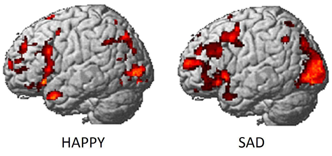 This Is Your Brain On Happy